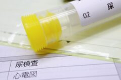 尿検査キット